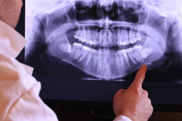 Best Emergency Dental Services for Seniors in Sausalito, CA