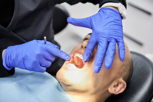 Best Emergency Cosmetic Dentistry in Sausalito, CA
